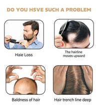 Anti Hair Loss Shampoo Fast Growing Repair Damaged Scalp Dry Frizzy Treatment Deep Nourishment Moisturizing Regrowth Conditioner - BlissFully