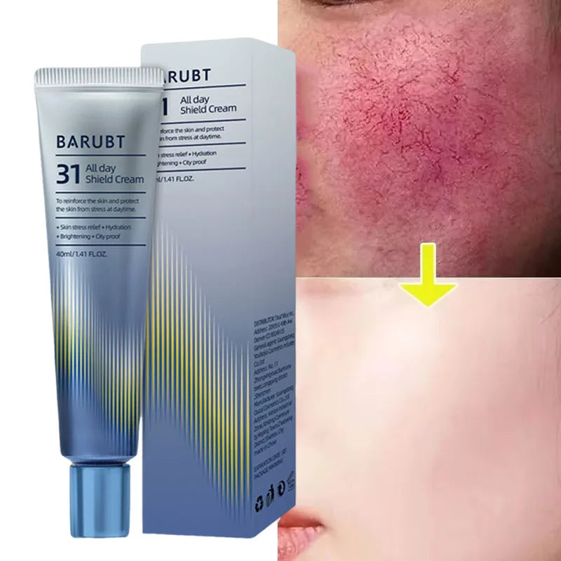Repair Facial Redness Cream Instant Spider Vein Remove Sensitive Skin Sooth Anti Redness Rosacea Treat Lotion Korean Cosmetics - BlissFully