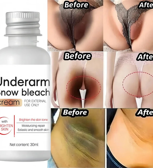 Whitening Cream Private Parts Underarm Bleaching Serum Whiten Butt Knee Brighten Inner Thigh Intimate Parts Dark Remove Melanin