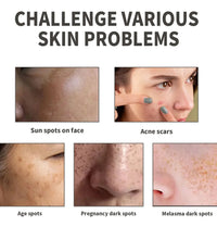 Vitamin B5 Face Serum Smooth Moisturizing Repair Dry Skin Aloe Soothe Pores Shrink Firming Hydrating Oil Control Facial Essence - BlissFully