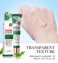 SADOER Tea Tree Acne Removing Cream Facial skincare Oil Control Face Gel Creams Hydrating Moisturizing Facial Cream Skin Care - BlissFully