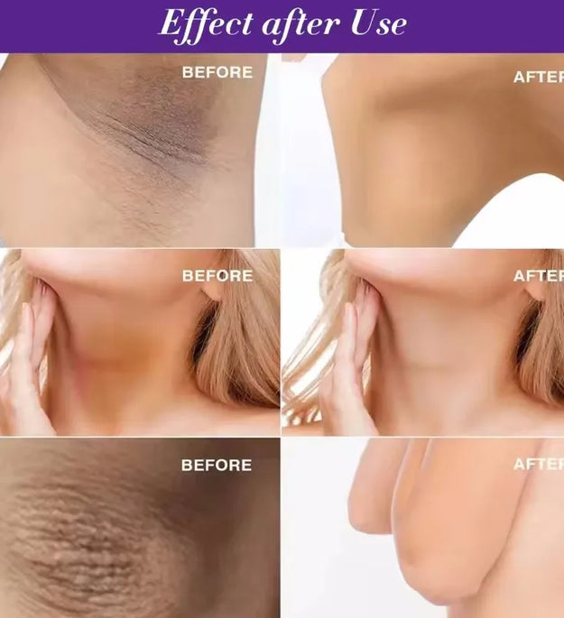 50g Body Underarm Whitening Cream Private Parts Bleaching Whiten Butt Knee Brighten Inner Thigh Intimate Dark Remove Melanin