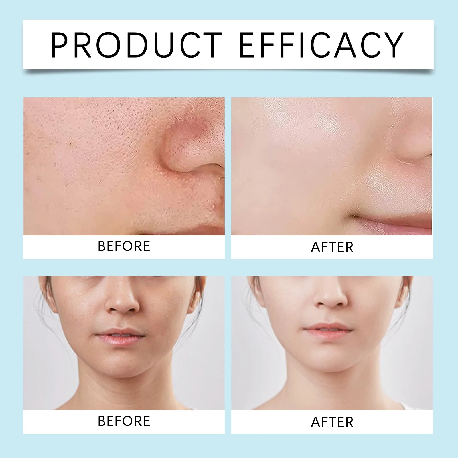 HOYGI Salicylic Acid Toning Solution To Remove Acne Oil Control and Moisturize Skin Rejuvenating Moisturizing Lotion Skincare