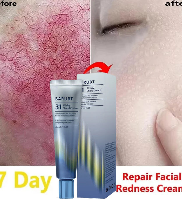 Repair Facial Redness Cream Instant Spider Vein Remove Sensitive Skin Sooth Anti Redness Rosacea Treat Lotion Korean Cosmetics - BlissFully