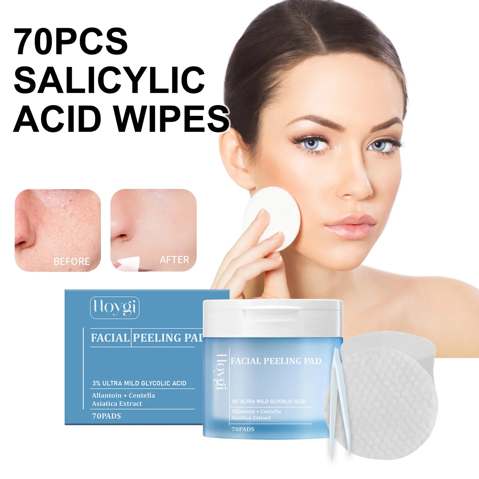 Hoygi 70pcs Salicylic Acid Exfoliating Pads for Face Gentle Skin Brightening Toner Wipes with Glycolic Acid for Smooth Texture