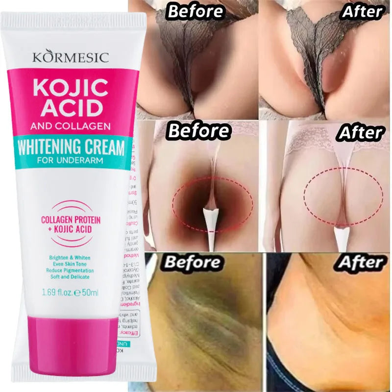 Whitening Cream Private Parts Underarm Bleaching Serum Whiten Butt Knee Brighten Inner Thigh Intimate Parts Dark Remove Melanin