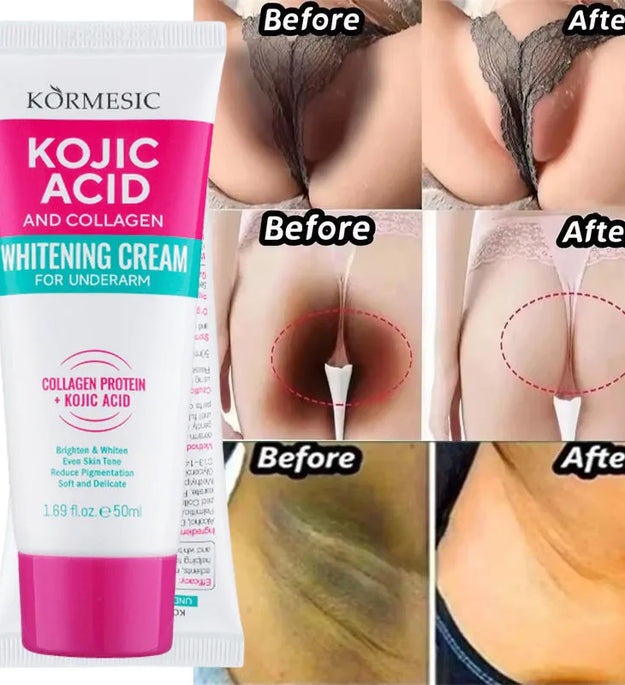 Whitening Cream Private Parts Underarm Bleaching Serum Whiten Butt Knee Brighten Inner Thigh Intimate Parts Dark Remove Melanin