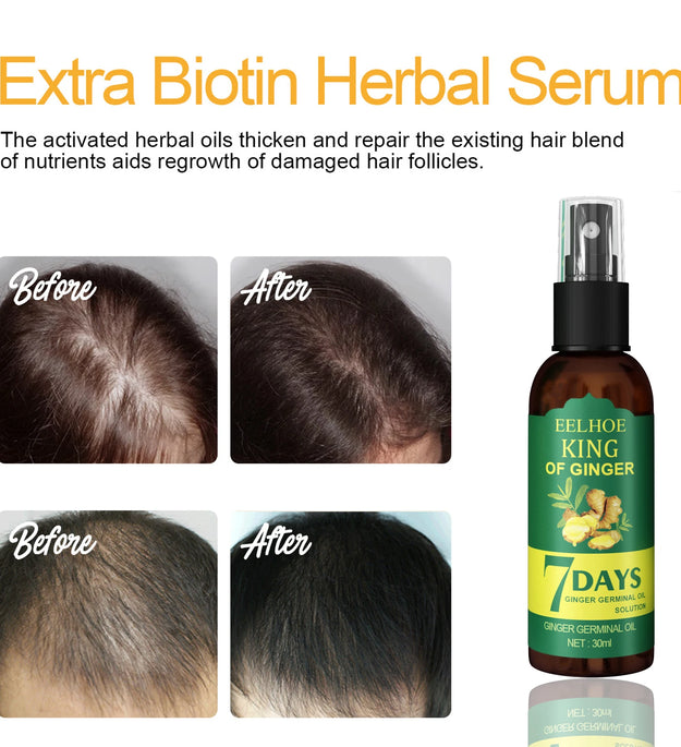 Ginger Care Hair Spray Hair Growth Essence Nourish Hair Roots Massag Scalp Repair Hair Quality Control Oil Hair Care Solution - BlissFully