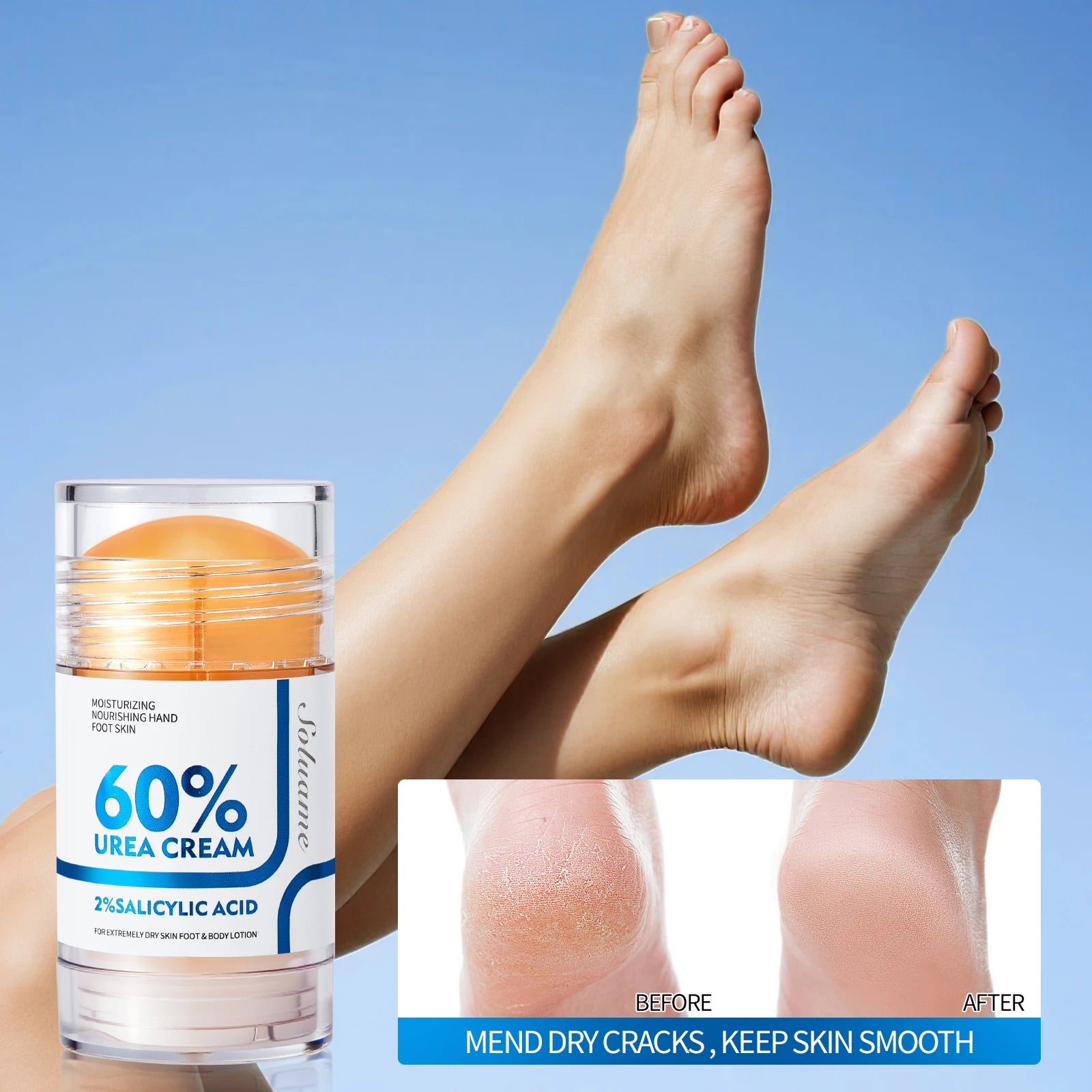 2 Pcs 60% Urea Foot Cream Stick with 2% Salicylic Acid, Foot Care Cream Moisturizer for Dry Cracked Feet, Knees, Hands
