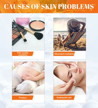 Freckle Whitening Face Cream Papaya Day Night Sun Spots Corrector Fade Pigment Brighten Skin Tone Blemish Bleaching Nourishing - BlissFully