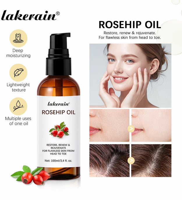 Organic Rosehip Oil Rose Hips Face Oils 30ml Fast-Absorbing Skin Care Moisturizer Face Oil Organic Rosehip Seed Oil Essence
