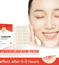 Hydrocolloid Acne Patches 2 Sizes Invisible Makeup-Friendly Pore Care Acne Pimple Patch Breathable for Comedones Treatment - BlissFully