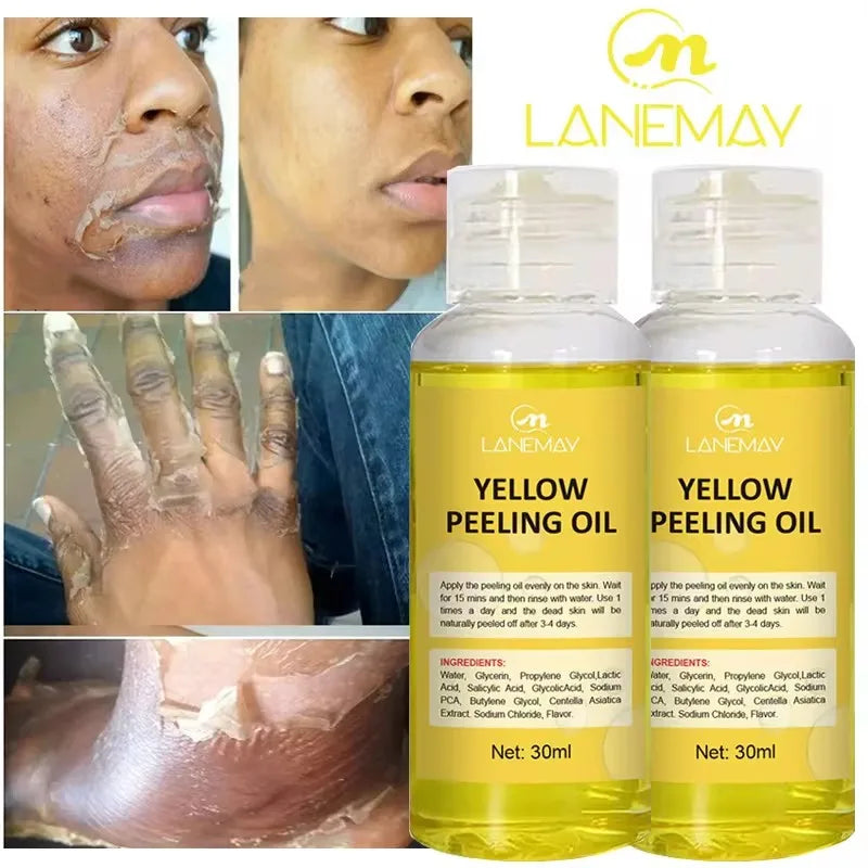 Strong Yellow Peeling Oil Bleach Dark Skin Whiten Lotion Lighten Body Elbow Knee Hand Exfoliate Dead Skin Nourish Even Skin Tone - BlissFully