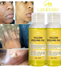 Strong Yellow Peeling Oil Bleach Dark Skin Whiten Lotion Lighten Body Elbow Knee Hand Exfoliate Dead Skin Nourish Even Skin Tone - BlissFully