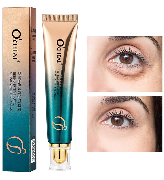 OCHEAL Eye Moisturizing Cream Fades Fine Lines Anti Dark Circles Eye Serum Remove Eye Bag Puffiness Anti-Aging Firmness Eye Care