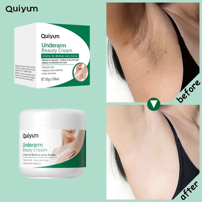 Quiyum Underarm Body Cream Armpit Legs Knee Elbow Cream Dull Remove Dark Spots Melanin Brighten Skin Care 30g