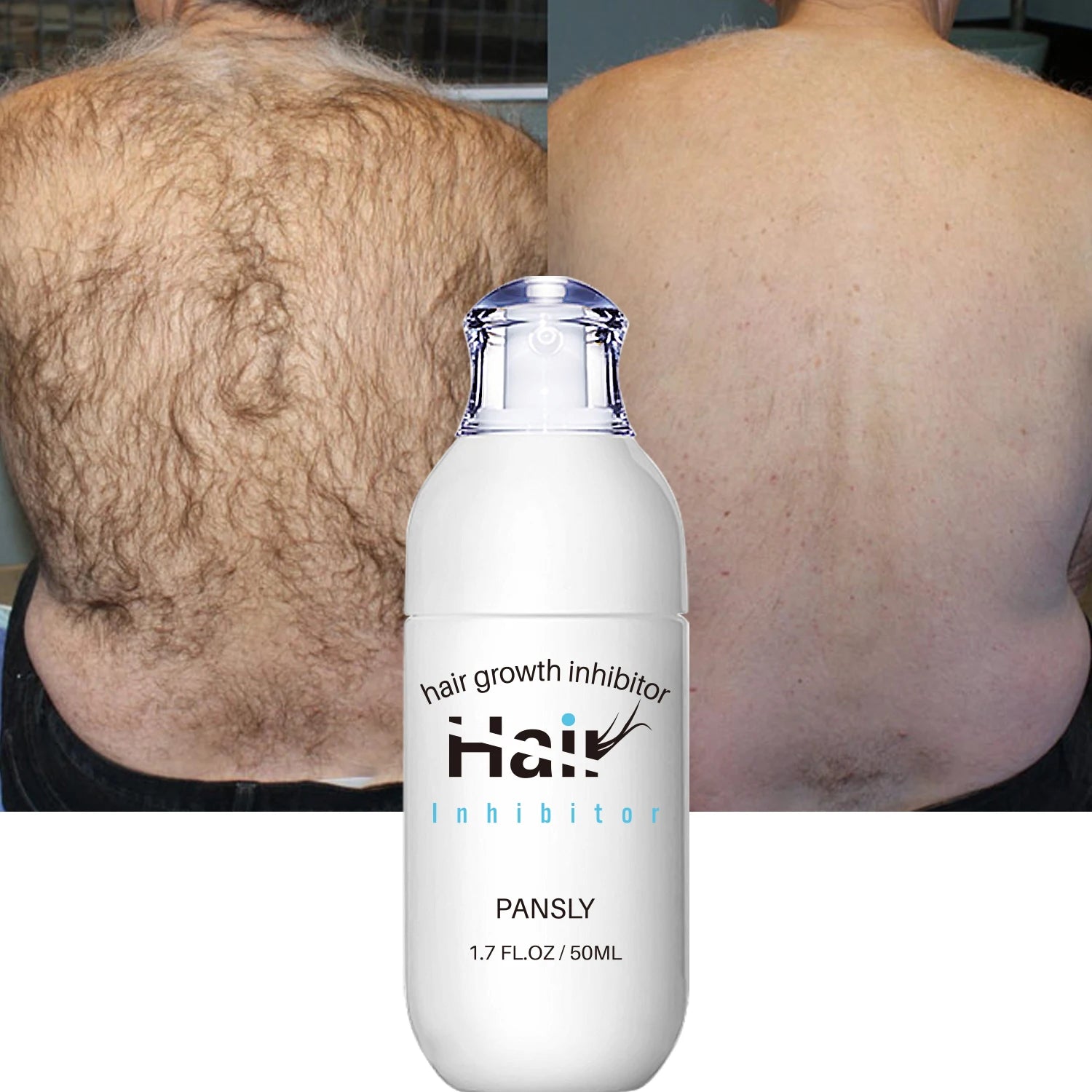 100ML Hair Removal Spray Hair Growth Inhibitor Spray Painless Hair Reduction Permanently Inhibits Hair Growth Skin Silky Smooth - BlissFully