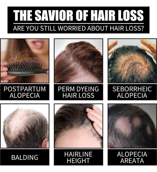 Collagen B7 Vitamin Hair Care Essential Oil Nourish Scalp Preventing Hair Loss Stabilizing Hair Roots Protecting Hair Follicles