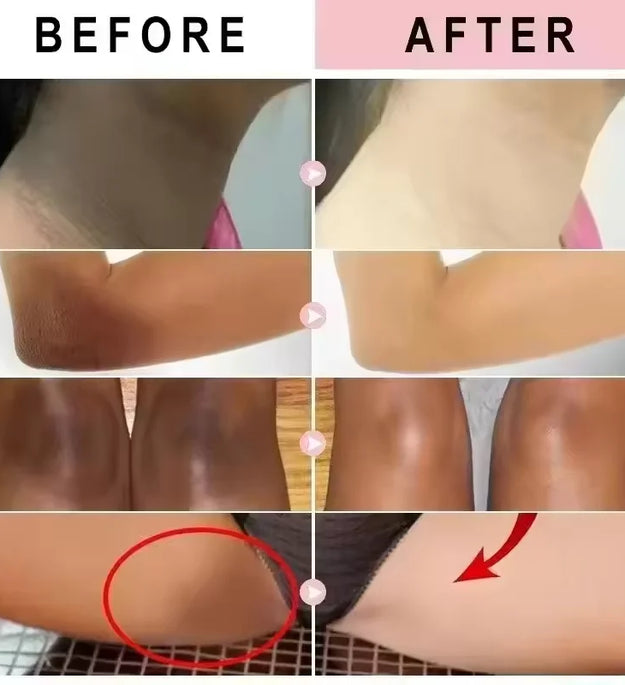 Body Whitening Cream Dark Skin Armpit Lightening Intimate Areas Underarm Bleaching Private Parts Whiten Cream Body Lotion Beauty