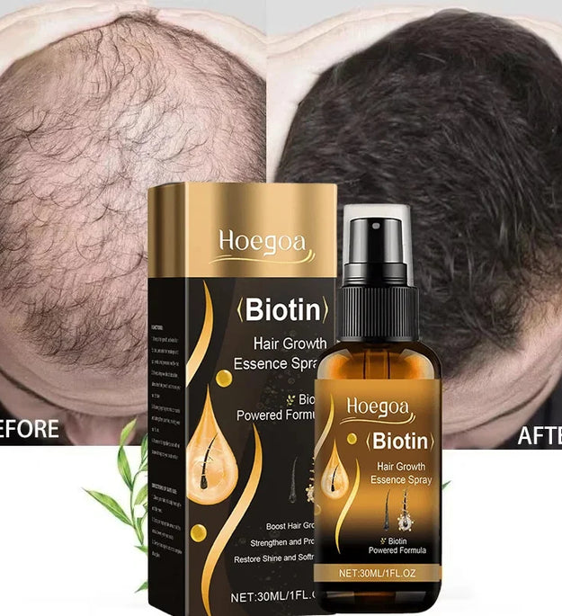 Biotin Fast Hair Growth Spray Anti Hair Loss Serum Prevent Baldness Treatment Scalp Beard Beauty Essence Hair Care Products 30ml