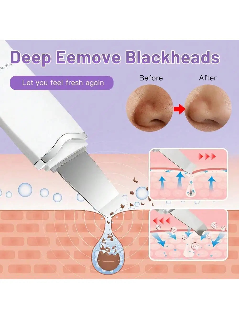 Ultrasonic Skin Scrubber Scrubber Deep Vibrate Facial Cleaner Shovel Face Scrubber Peeling Black Head Remover Facial Massager - BlissFully