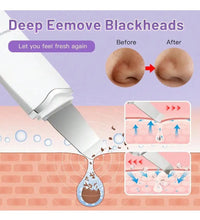 Ultrasonic Skin Scrubber Scrubber Deep Vibrate Facial Cleaner Shovel Face Scrubber Peeling Black Head Remover Facial Massager - BlissFully