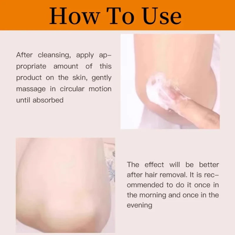 Nicotinamide Whitening Cream For Dark Skin Effective Lighten Thigh Inner Bleach Remove Melanin Private Parts Brightening Cream