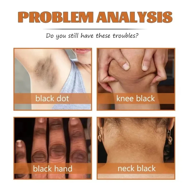 Strong Yellow Peeling Oil Bleach Dark Skin Whiten Lotion Lighten Body Elbow Knee Hand Exfoliate Dead Skin Nourish Even Skin Tone - BlissFully