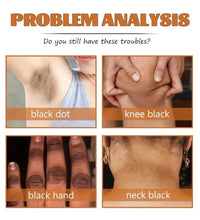 Strong Yellow Peeling Oil Bleach Dark Skin Whiten Lotion Lighten Body Elbow Knee Hand Exfoliate Dead Skin Nourish Even Skin Tone - BlissFully