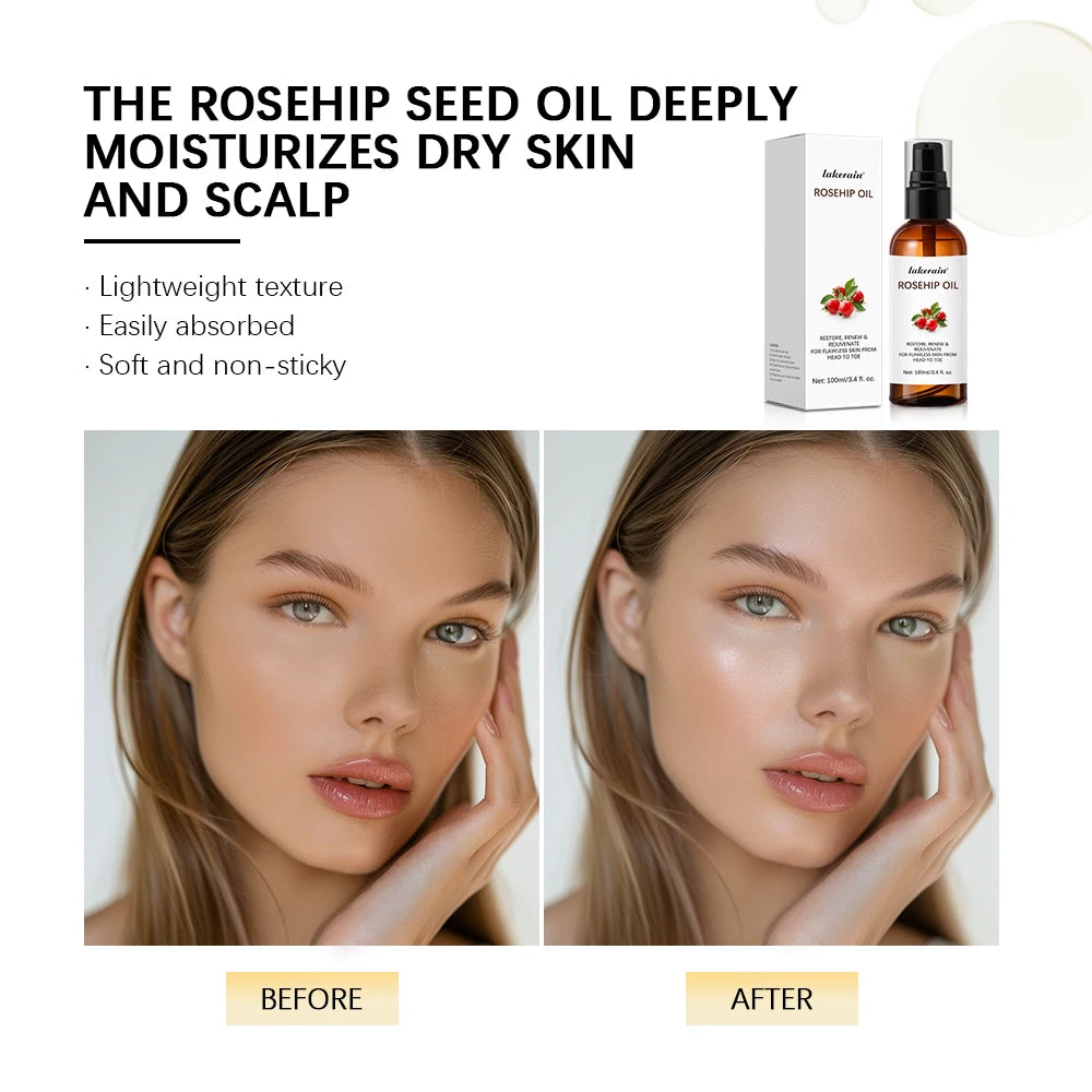 Organic Rosehip Oil Rose Hips Face Oils 30ml Fast-Absorbing Skin Care Moisturizer Face Oil Organic Rosehip Seed Oil Essence