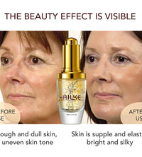 AILKE 24K Collagen Facial Whitening Set, Reduce Black Spots, Freckles, Brightening, Moisturizing Beauty Set For All Skin Types - BlissFully