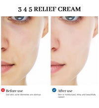 345 Relief Cream Comprehensive solution to skin problems Anti-sugar and antioxidant Brightening skin Improving acne marks Moistu - BlissFully