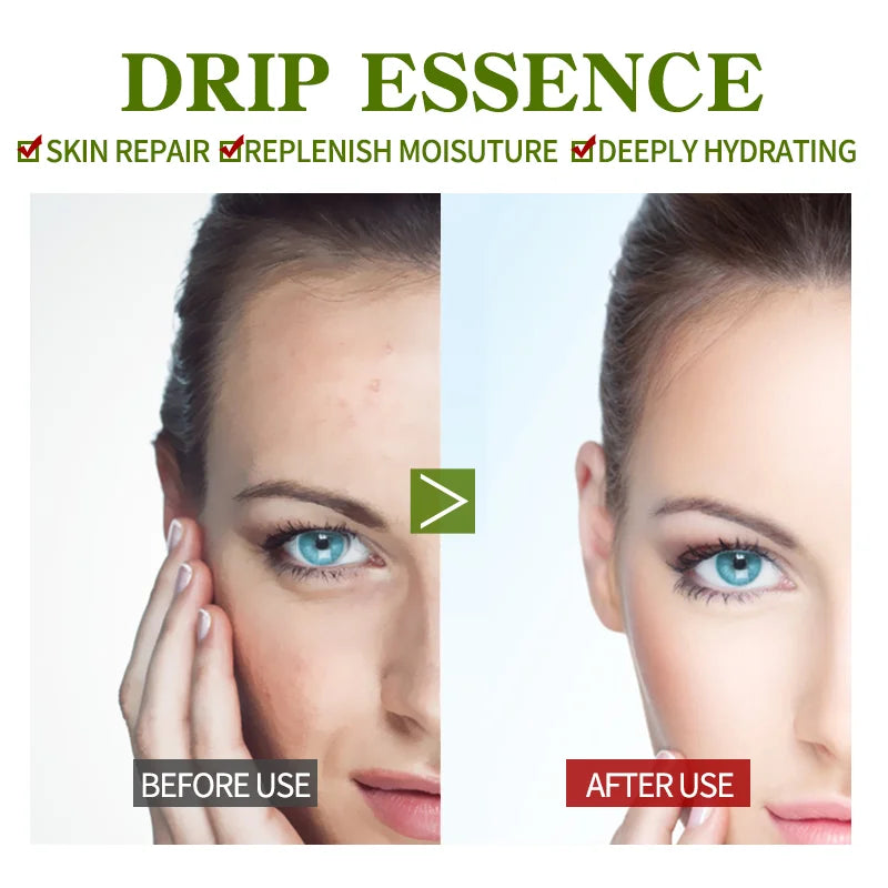 Vitamin B5 Face Serum Smooth Moisturizing Repair Dry Skin Aloe Soothe Pores Shrink Firming Hydrating Oil Control Facial Essence - BlissFully