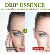 Vitamin B5 Face Serum Smooth Moisturizing Repair Dry Skin Aloe Soothe Pores Shrink Firming Hydrating Oil Control Facial Essence - BlissFully