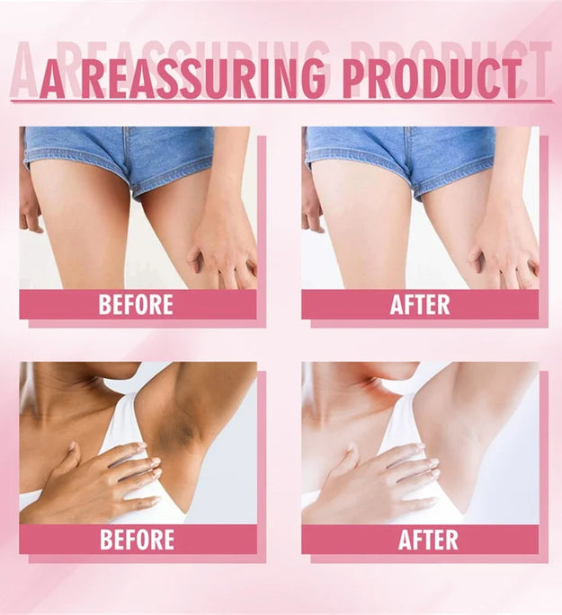 Niacinamide Body Whitening Cream For Underarm Bleaching Armpit Lightening Intimate Area  Moisturizer Korean Skin Care Product