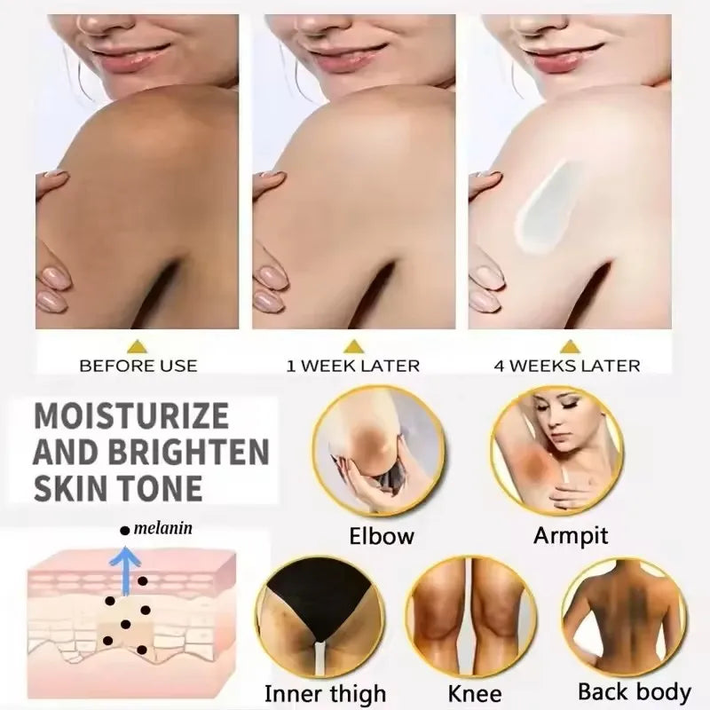 50g Body Underarm Whitening Cream Private Parts Bleaching Whiten Butt Knee Brighten Inner Thigh Intimate Dark Remove Melanin
