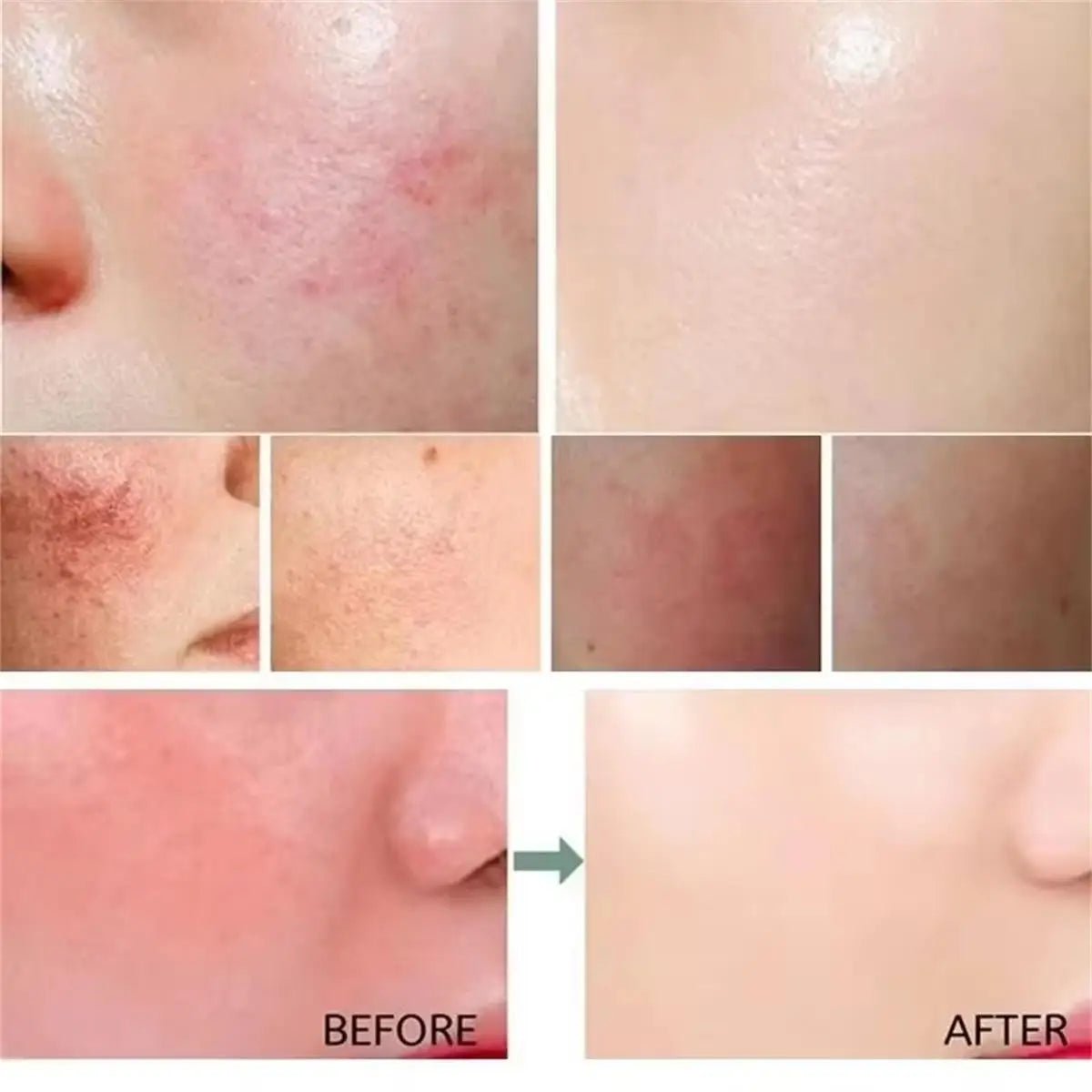 Repair Facial Redness Cream Instant Spider Vein Remove Sensitive Skin Sooth Anti Redness Rosacea Treat Lotion Korean Cosmetics - BlissFully