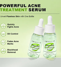 AUQUEST Herbal Acne Treatment Face Serum Salicylic Acid Oil Control Pimple Remover Facial Acne Removal Skin Care - BlissFully