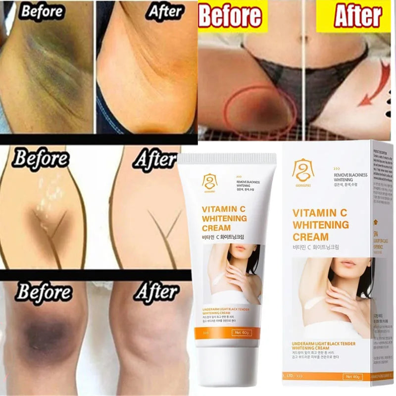 Nicotinamide Whitening Cream For Dark Skin Effective Lighten Thigh Inner Bleach Remove Melanin Private Parts Brightening Cream