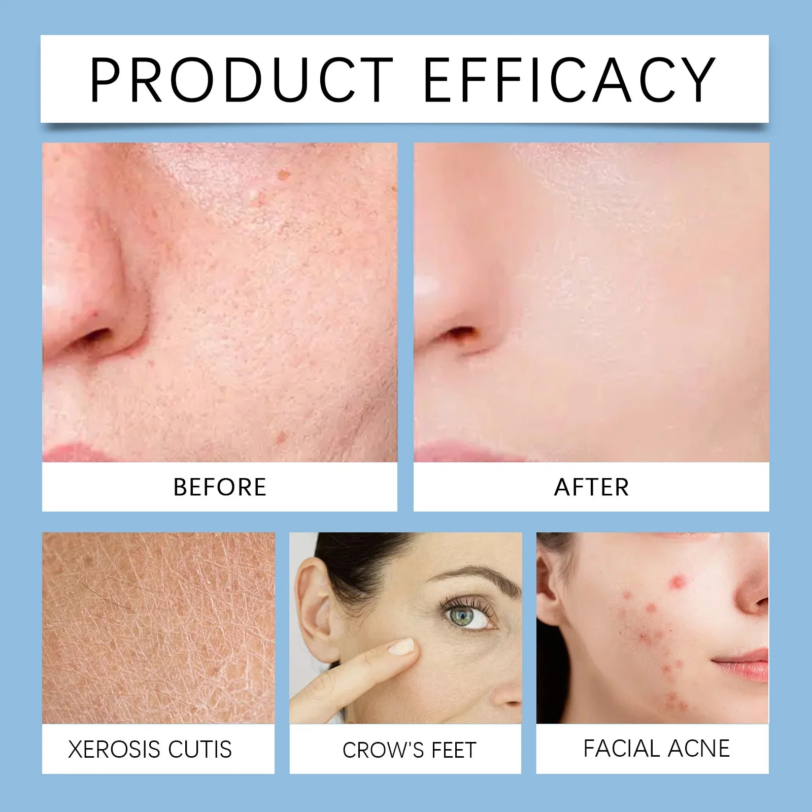 Hoygi 70pcs Salicylic Acid Exfoliating Pads for Face Gentle Skin Brightening Toner Wipes with Glycolic Acid for Smooth Texture