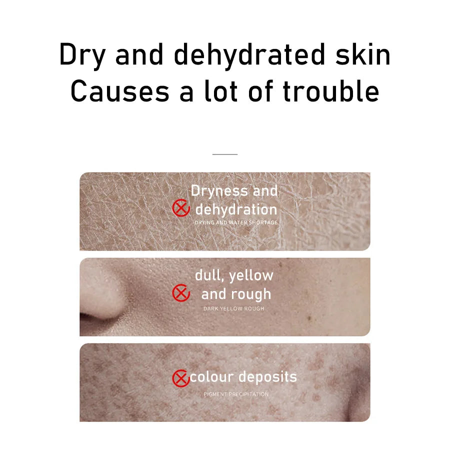 Rice Toner 70% Rice Extract Serum with Niacinamide, Rice Cleansing Foam, Deep Cleansing, Moisturizer for Dry Skin, Skin Care Set - BlissFully