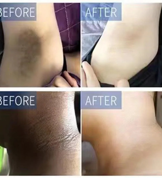 Body Whitening Cream Private Parts Underarm Knee Thigh Inner Melanin Bleaching Brighten Lotion Dark Skin Healthy White Body Care