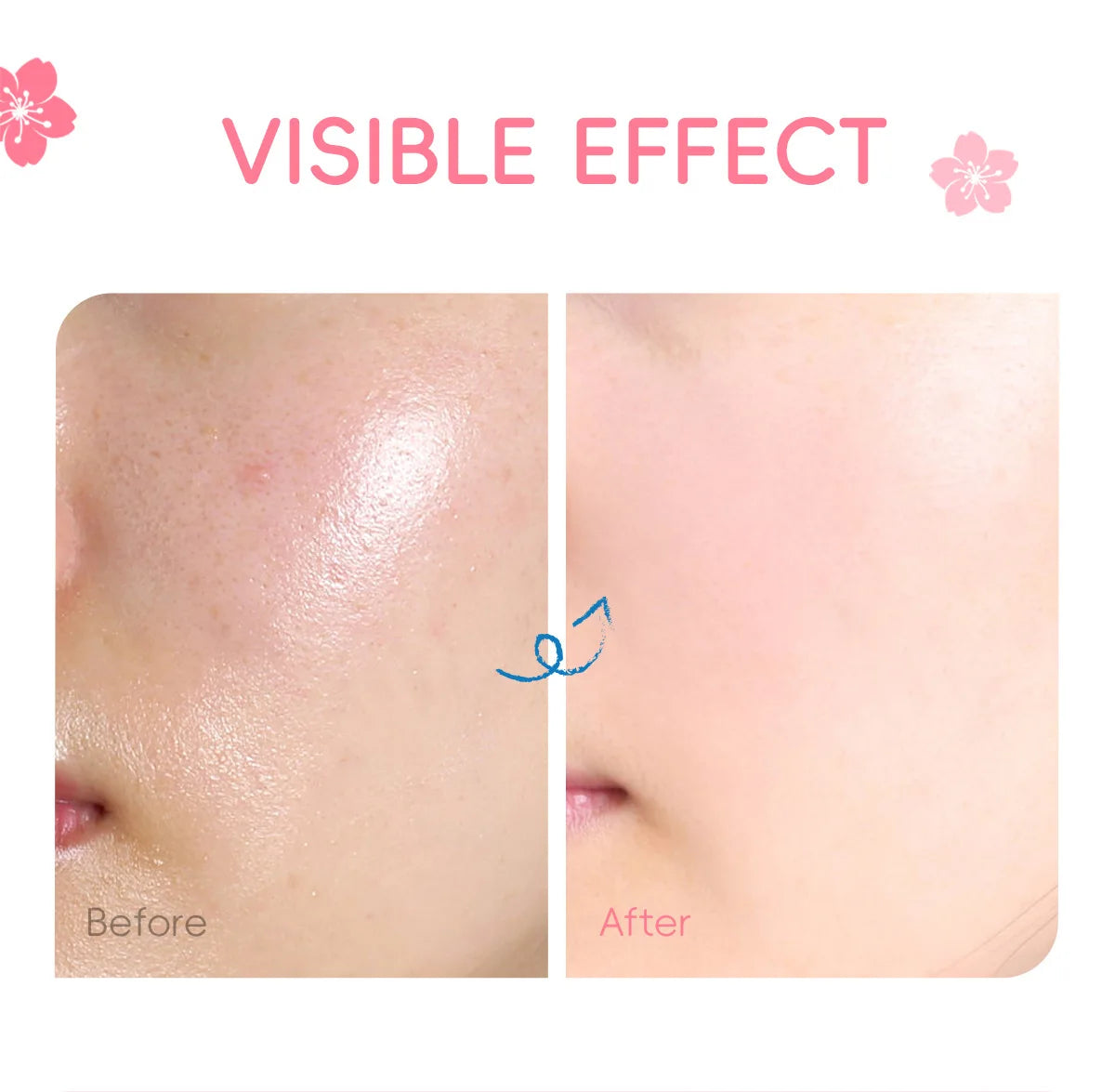 Laikou Sakura Essence Face Cream Anti-aging Remove Wrinkles Rich Cream Moisturizing Facial Serum Day Cream Winter Skincare