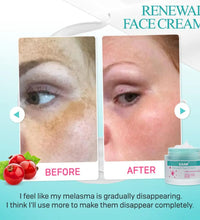 Saam Face Cream，Saam Renewal - BlissFully