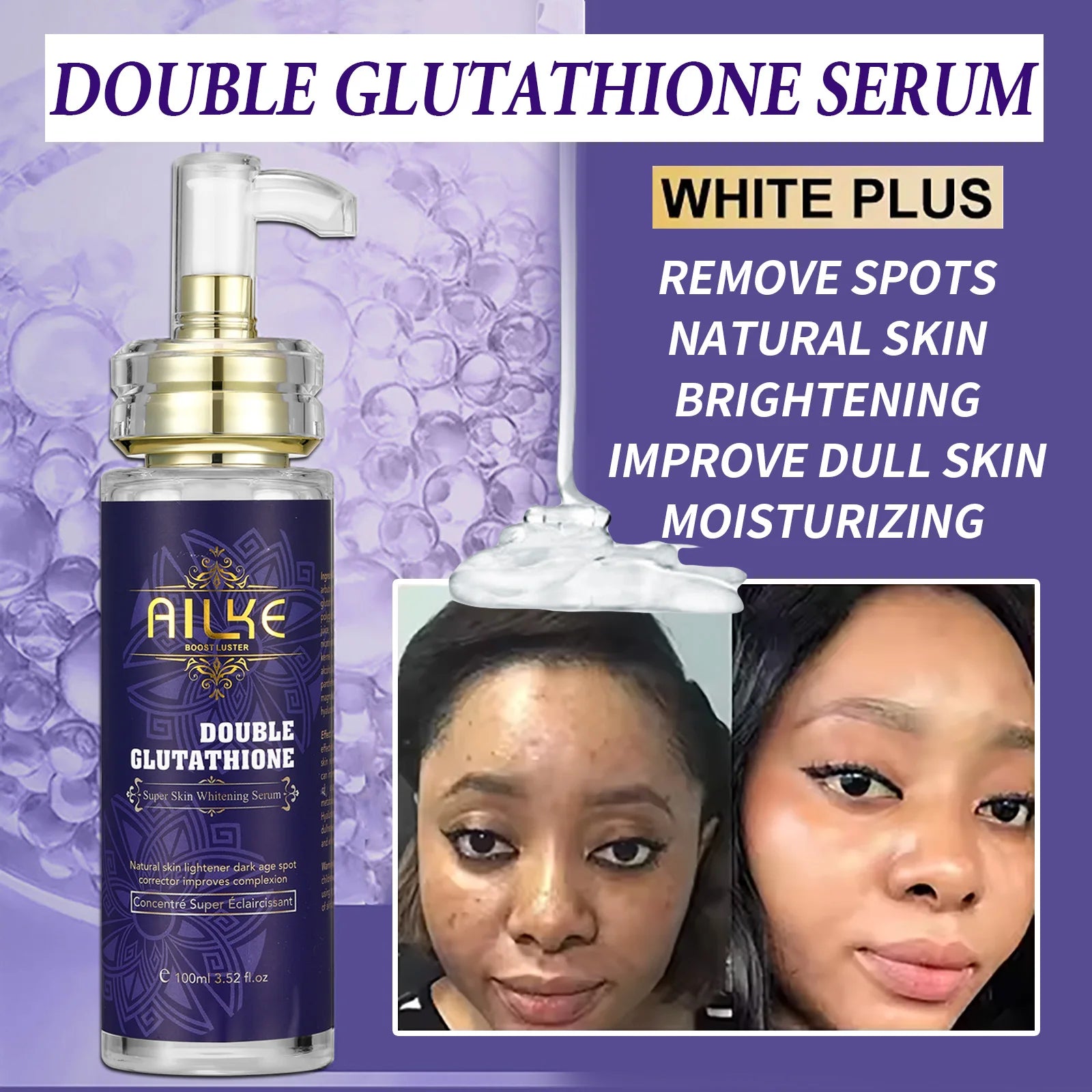 AILKE Glutathione 5-in-1 Women Skin Care Kit, With Body Lotion,  Serum, Dark Spot Removal Cream, Body Cream, Brightening Soap - BlissFully