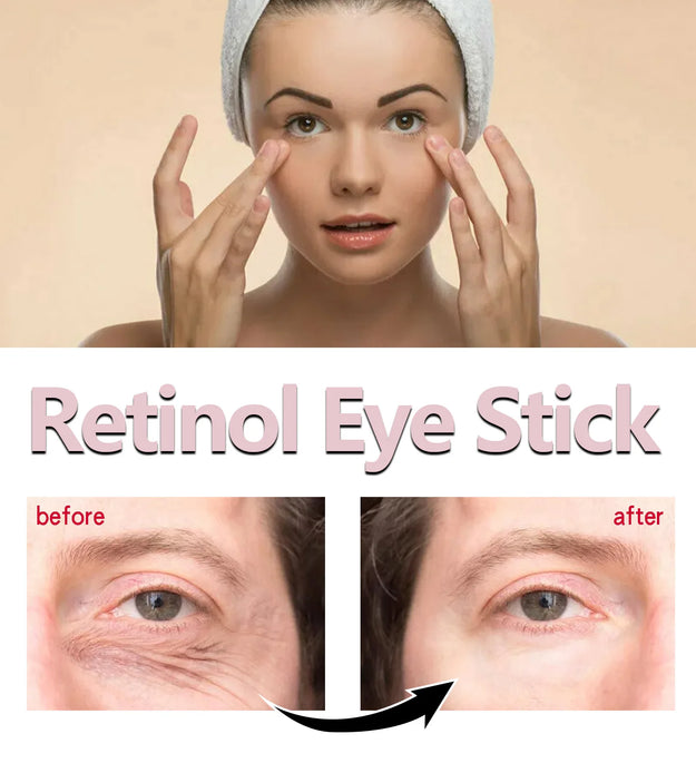 Retinol Eye Cream Stick Collagen Fade Fine Lines Wrinkle Lightening Dark Circles Firming Eye Bags Puffiness Moisturizing Eye Cre