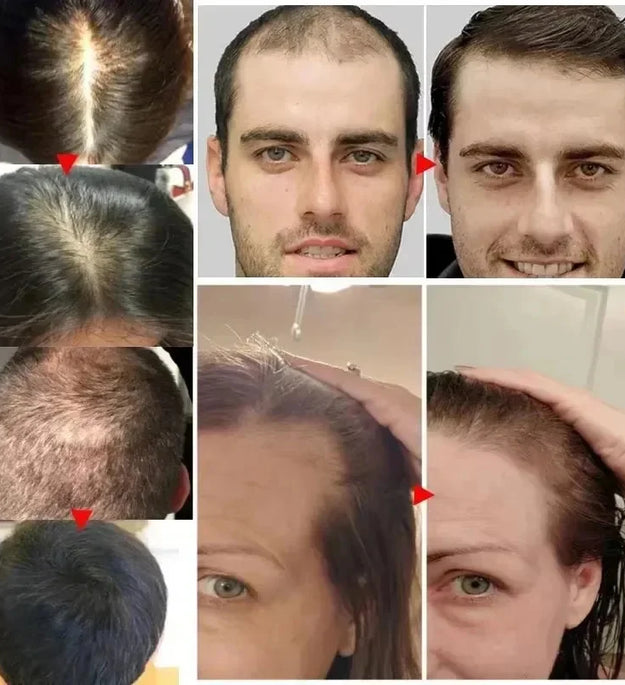 Biotin Fast Hair Growth Spray Anti Hair Loss Serum Prevent Baldness Treatment Scalp Beard Beauty Essence Hair Care Products 30ml