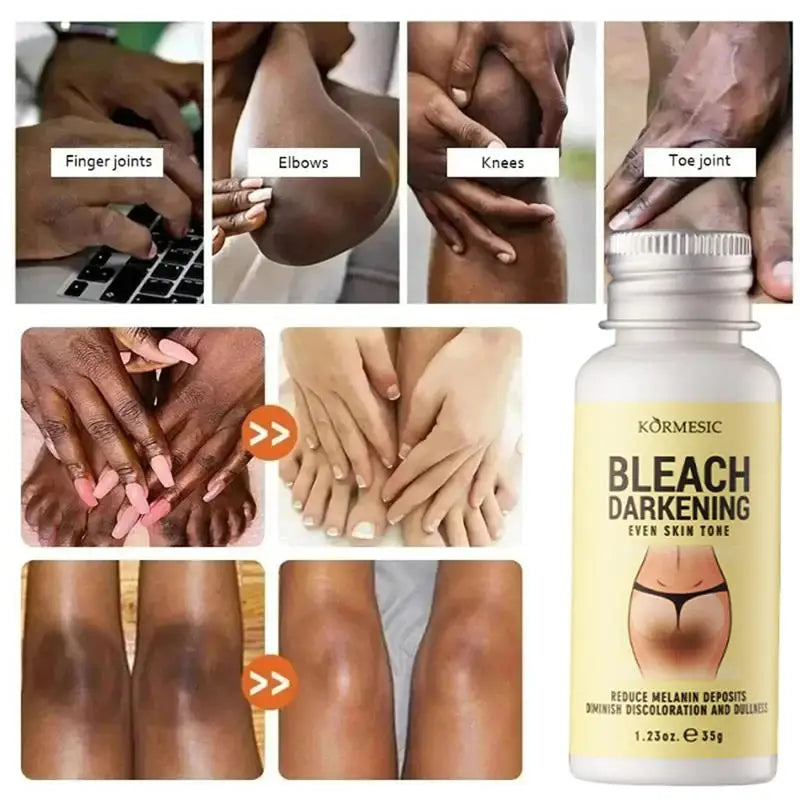 Whitening Body Cream Private Parts Underarm Bleaching Serum Whiten Butt Knee Brighten Inner Thigh Intimate Dark Remove Melanin