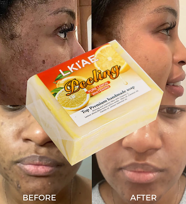 LKIAE Organic Lemon Cold Processed Soap, Brightening, Moisturizing, With Vitamin C, Kojic Acid, Anti Acne and Dark Spots