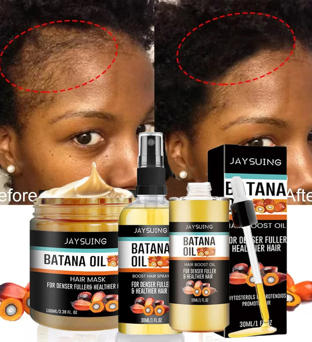 Fast Hair Growth Set Batana Oil Traction Alopecia Hair Mask Anti Break Loss Hair Growth Oil Baldness Treatment Hair Health Care